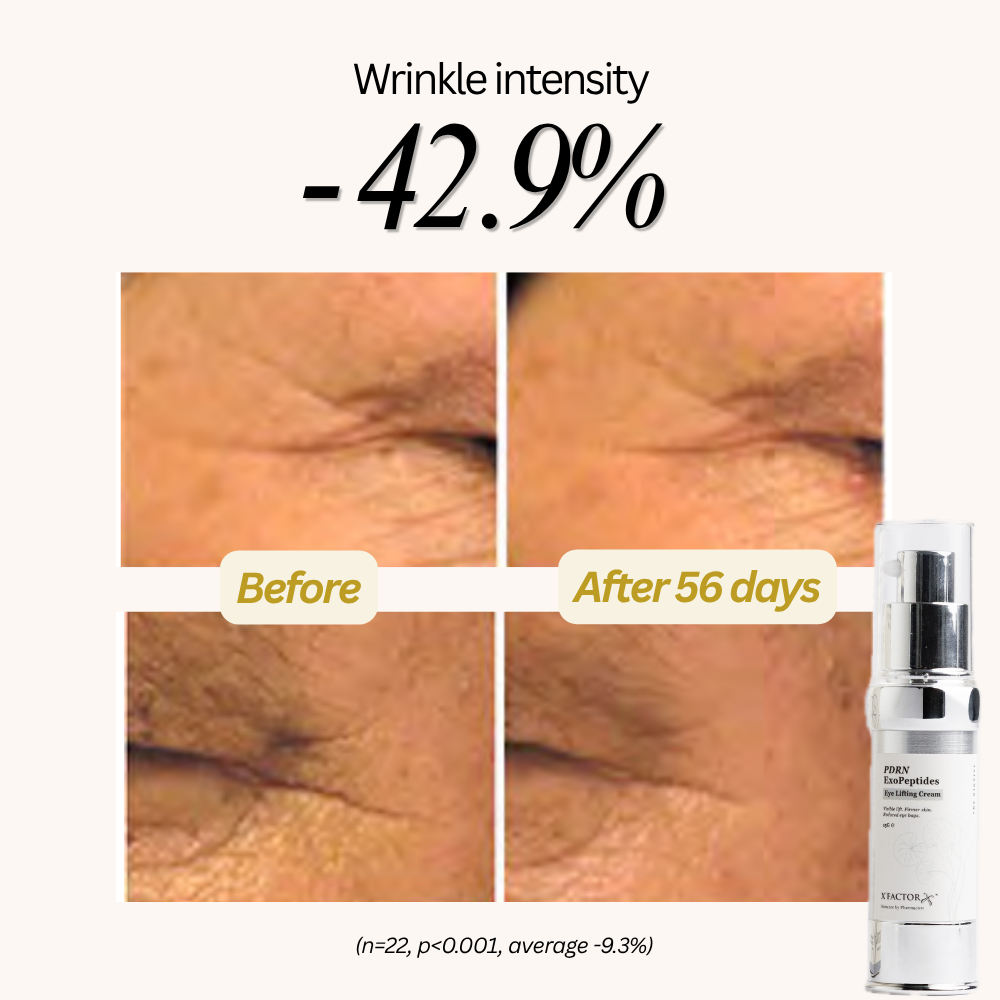 PDRN Exopeptides™ Eye Lifting Cream 15g