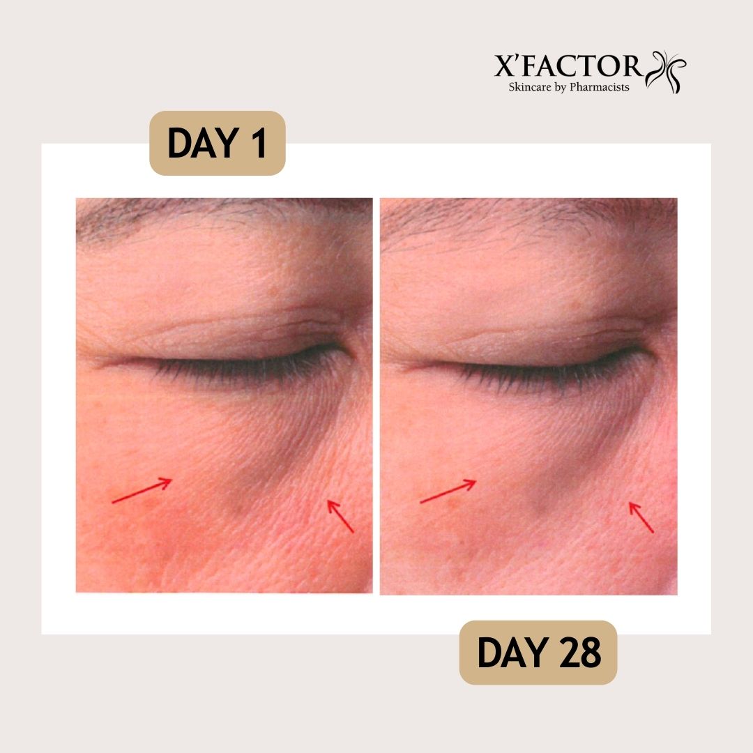 Advanced 30% Proxylane Face Cream – X'Factor Skincare